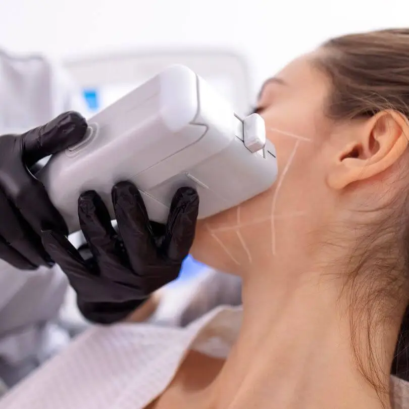 HIFU 12D – Lifting y Reafirmación Facial sin Cirugía